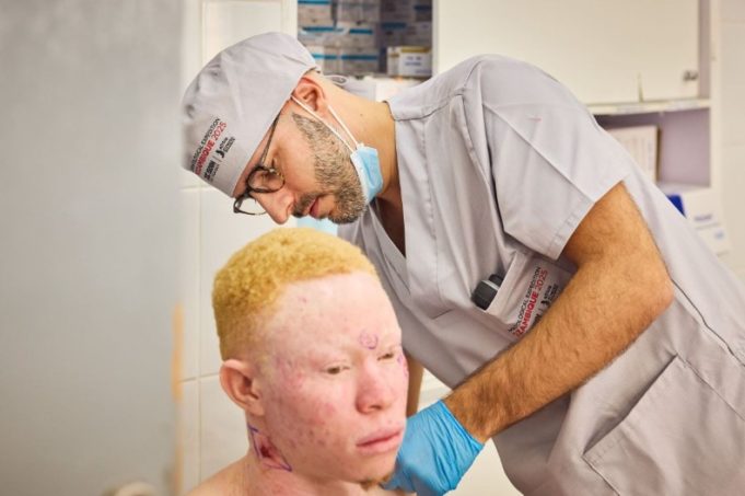 Isdin y África Directo tratan a más de 5.200 personas con albinismo en Mozambique